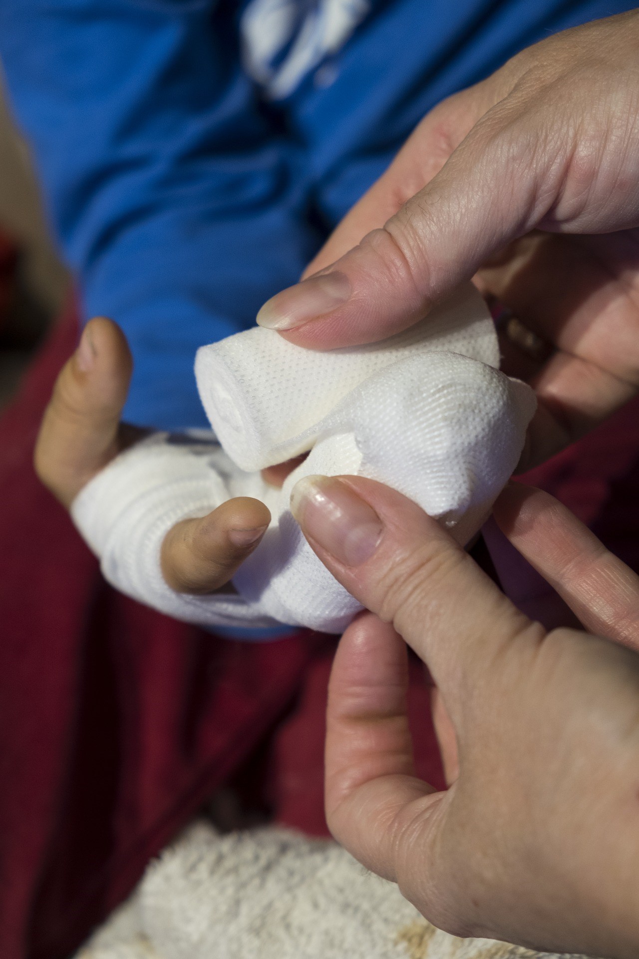 Hand being bandaged